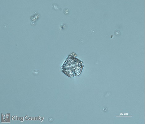 Photo of Protoperidinium brevipes